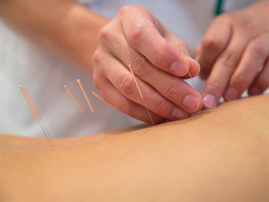 Pregnancy Acupuncture By No.1 Acupuncturist Monisha